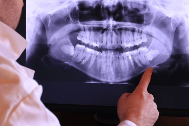 Best Emergency Dental Care for Abscessed Tooth in Andrews, IN