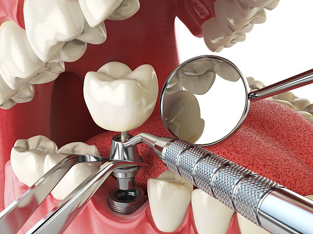 Best Mobile Emergency Dentist in Andrews, IN