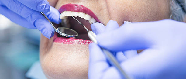 Best Emergency Dental Care for Abscessed Tooth in Andrews, IN